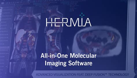 hermes ros|Hermes mri software.